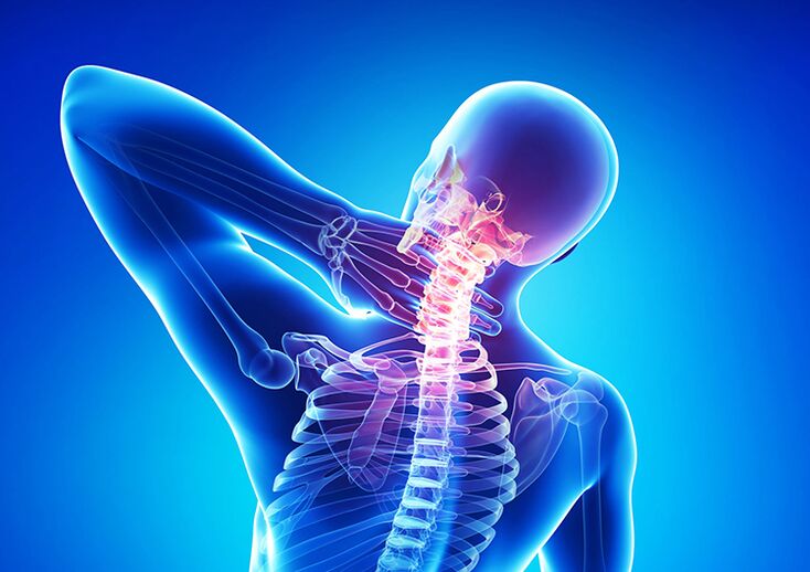 Osteocondroza coloanei vertebrale este o boală care afectează cartilajul articular și vertebrele.